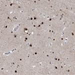 MCM9 Antibody in Immunohistochemistry (Paraffin) (IHC (P))