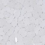 MCM9 Antibody in Immunohistochemistry (Paraffin) (IHC (P))