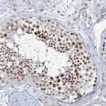 MCM9 Antibody in Immunohistochemistry (Paraffin) (IHC (P))