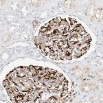 CDCP2 Polyclonal Antibody