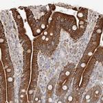 GCNT1 Polyclonal Antibody