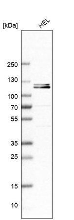 DNAJC6 Antibody in Western Blot (WB)