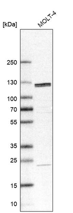 SART1 Antibody in Western Blot (WB)