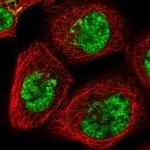 SART1 Polyclonal Antibody