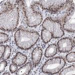 SART1 Antibody in Immunohistochemistry (Paraffin) (IHC (P))