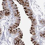 RSPH4A Antibody in Immunohistochemistry (IHC)