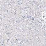 RSPH4A Antibody in Immunohistochemistry (IHC)