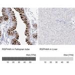 RSPH4A Antibody