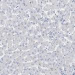RSPH4A Antibody in Immunohistochemistry (IHC)