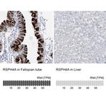 RSPH4A Antibody