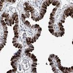 RSPH4A Antibody in Immunohistochemistry (Paraffin) (IHC (P))