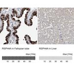RSPH4A Antibody in Immunohistochemistry (IHC)