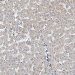 RSPH4A Antibody in Immunohistochemistry (IHC)