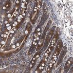 KTI12 Polyclonal Antibody