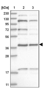 KTI12 Antibody in Western Blot (WB)