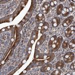 EFCAB2 Antibody in Immunohistochemistry (Paraffin) (IHC (P))
