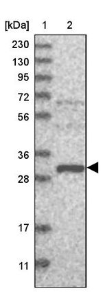 EFCAB2 Antibody in Western Blot (WB)