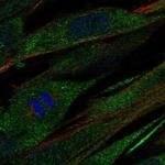 COL21A1 Polyclonal Antibody