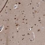 ZNF518B Polyclonal Antibody