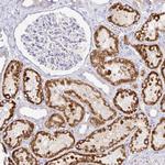 PKHD1 Polyclonal Antibody