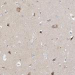 TSSC1 Polyclonal Antibody