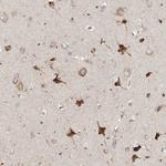 TSSC1 Polyclonal Antibody