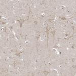 TSSC1 Antibody in Immunohistochemistry (IHC)