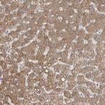 MDGA1 Polyclonal Antibody