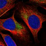 YAE1D1 Polyclonal Antibody