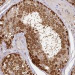 YAE1D1 Antibody in Immunohistochemistry (Paraffin) (IHC (P))