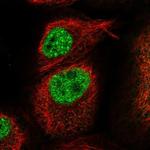 KLHL17 Polyclonal Antibody