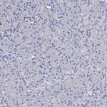 KLHL17 Antibody in Immunohistochemistry (Paraffin) (IHC (P))