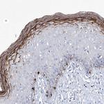 KLHL17 Antibody in Immunohistochemistry (Paraffin) (IHC (P))