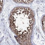 KLHL17 Antibody in Immunohistochemistry (Paraffin) (IHC (P))