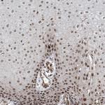 SDE2 Antibody in Immunohistochemistry (Paraffin) (IHC (P))