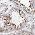 SDE2 Antibody in Immunohistochemistry (Paraffin) (IHC (P))