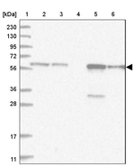 Thromboxane synthase Antibody in Western Blot (WB)