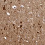 NECAB1 Antibody in Immunohistochemistry (Paraffin) (IHC (P))