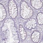 NECAB1 Antibody in Immunohistochemistry (Paraffin) (IHC (P))