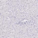 NECAB1 Antibody in Immunohistochemistry (Paraffin) (IHC (P))