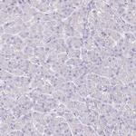 NECAB1 Antibody in Immunohistochemistry (Paraffin) (IHC (P))