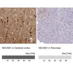 NECAB1 Antibody in Immunohistochemistry (IHC)