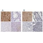 NECAB1 Antibody in Immunohistochemistry (IHC)