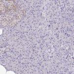 NECAB1 Antibody in Immunohistochemistry (IHC)