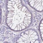 NECAB1 Antibody in Immunohistochemistry (IHC)