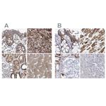 COQ3 Polyclonal Antibody