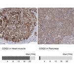 COQ3 Antibody