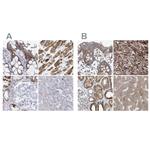 COQ3 Antibody in Immunohistochemistry (IHC)