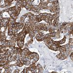 COQ3 Antibody in Immunohistochemistry (IHC)
