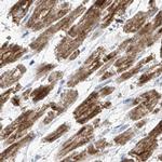 COQ3 Antibody in Immunohistochemistry (IHC)